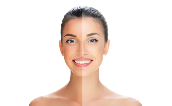 does sunscreen prevent tanning