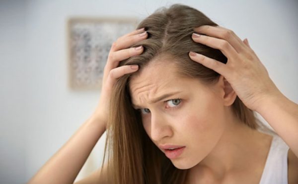 Scalp Psoriasis vs Dandruff