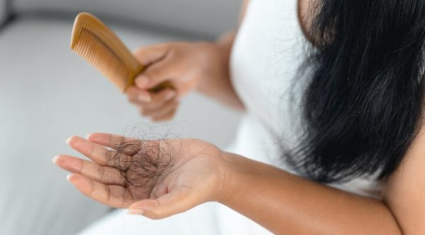 COVID Hair Loss
