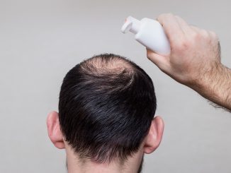 Best Hair Loss Shampoo