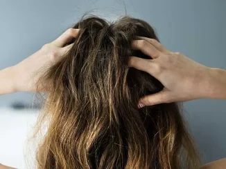 Itchy Scalp with No Dandruff