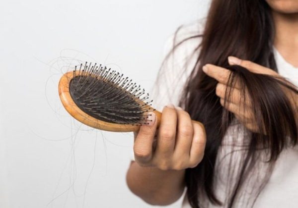 Thyroid Hair Loss