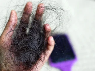 When Does Postpartum Hair Loss Start?