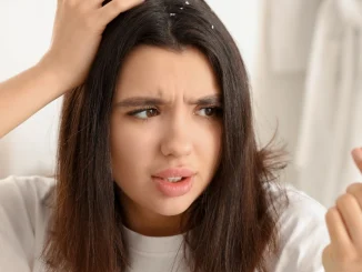 Can Dandruff Cause Hair Loss?