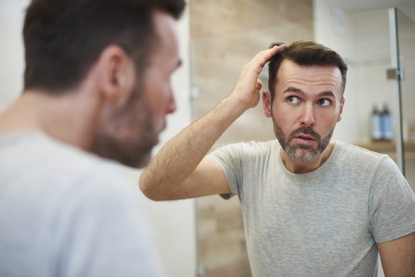 Does Testosterone Cause Hair Loss?