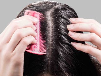 How to Get Rid of Dandruff Fast