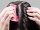 How to Get Rid of Dandruff Fast