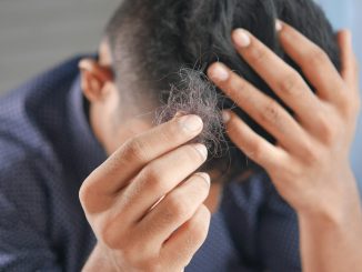 Mounjaro Side Effects Hair Loss