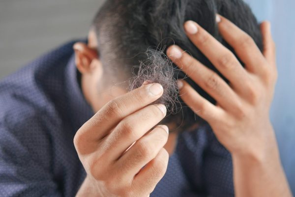  Mounjaro Side Effects Hair Loss