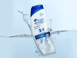 Does Head & Shoulders Cause Hair Loss?