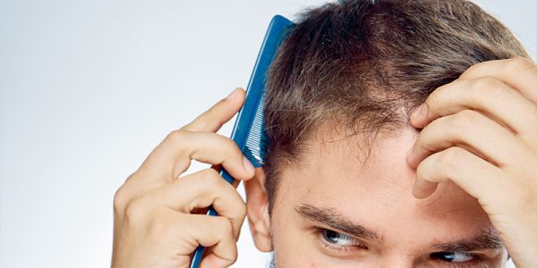 Dutasteride for Hair Loss