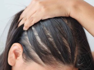 Hair Loss ICD-10