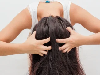 How to Remove Dandruff Permanently