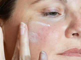 best moisturizer for redness