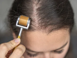 Derma Roller for Hair Growth