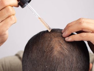 Best Hair Growth Oil for Men