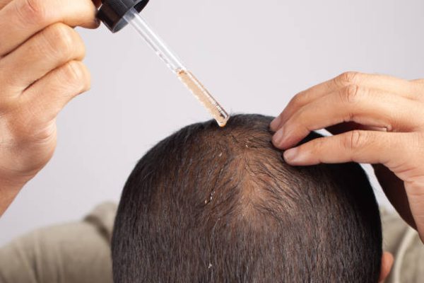 Best Hair Growth Oil for Men