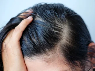 Shampoo for Oily Scalp